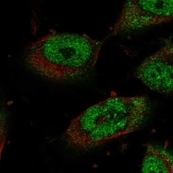 STOX1 Antibody, Novus Biologicals:Antibodies:Primary Antibodies